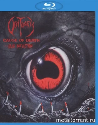 Obituary - Cause Of Death - Live Infection (2022)